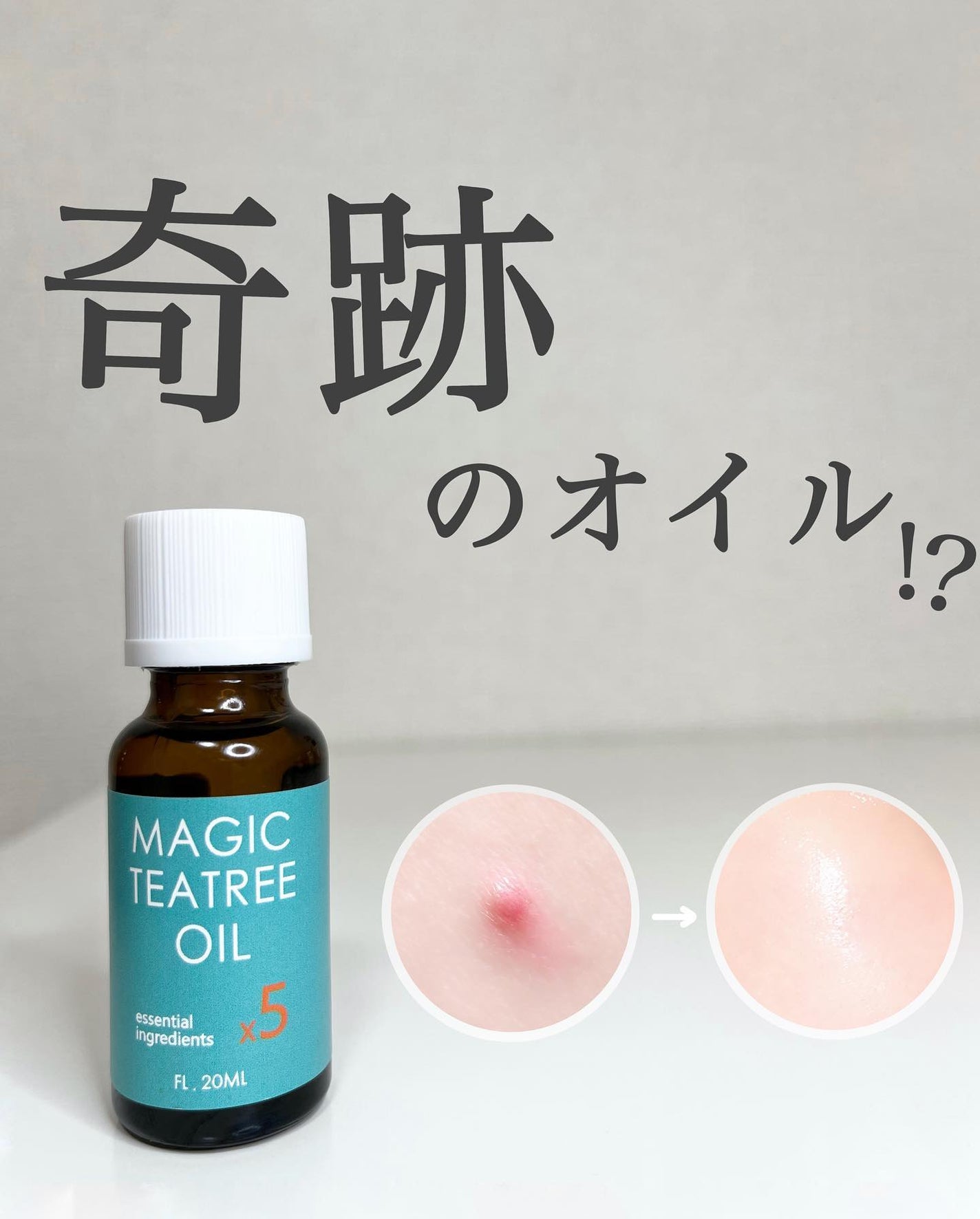 マジックティーツリーオイル/ブラン/フェイスオイルを使ったクチコミ(1枚目)