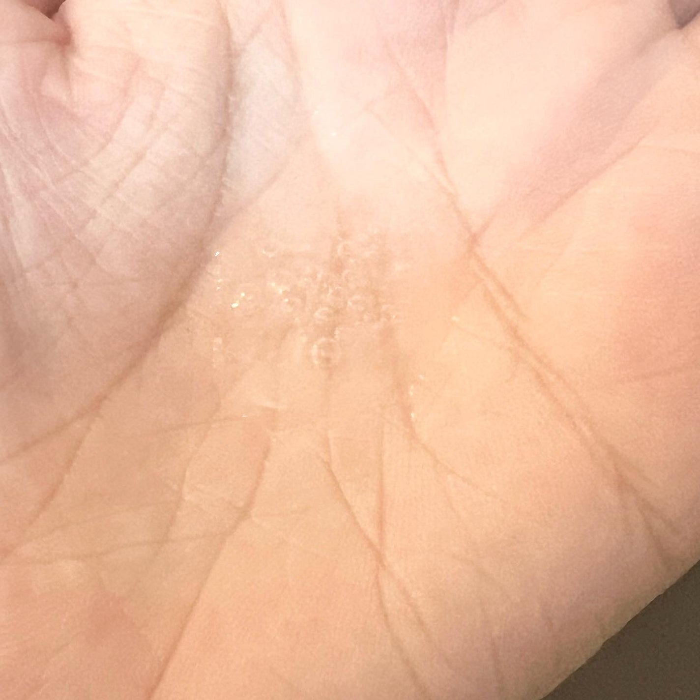 プレミアム高浸透発酵エッセンスセラム/NARTH/美容液を使ったクチコミ(3枚目)