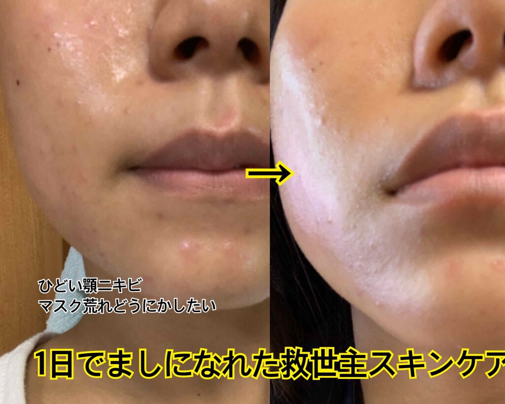 グリーンタンジェリン ビタC ダークスポットケアセラム/goodal/美容液を使ったクチコミ(1枚目)