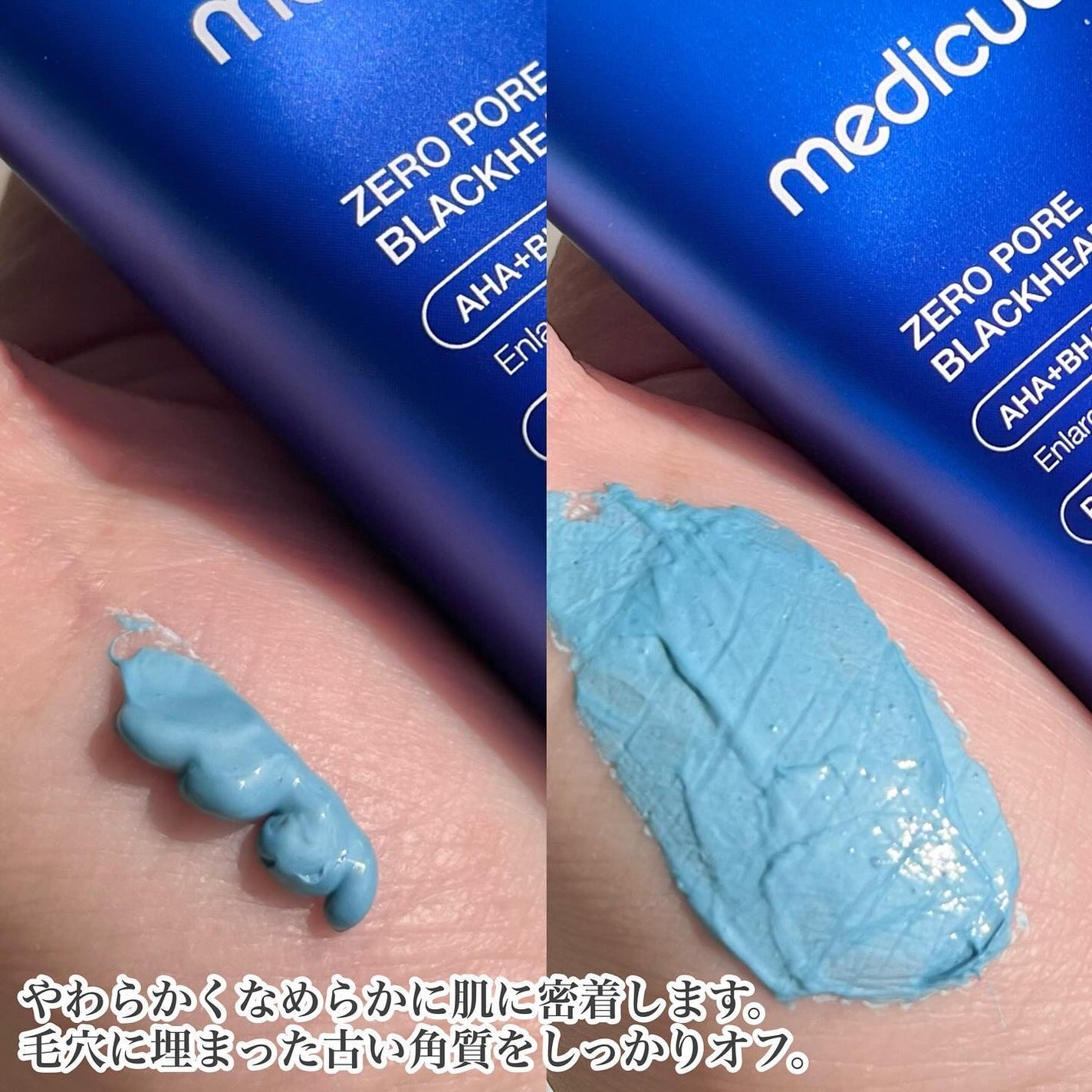 ひみ ✿ on LIPS 「medicube新作📣✨✨真っ青!なクレイマスクで毛穴つるん💙..」(3枚目)