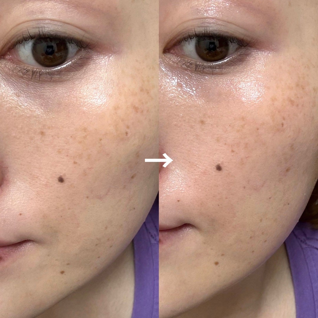 レチノール×シカ バウンスボールセラム/LIALUSTER/美容液を使ったクチコミ(7枚目)