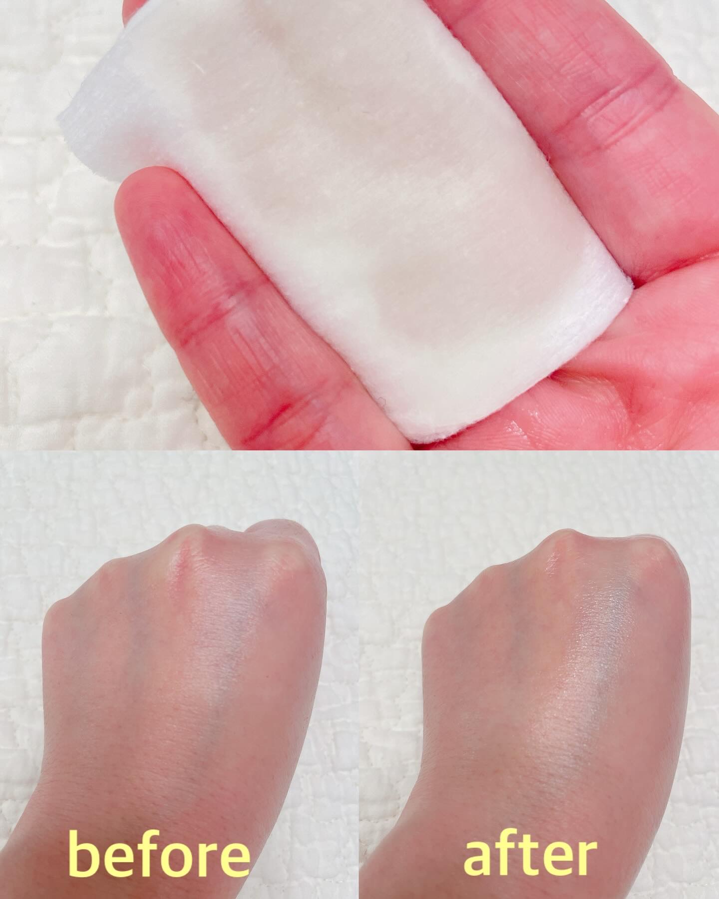 ナイアシンアミドブレミッシュケアセラム/ONE THING/美容液を使ったクチコミ（2枚目）