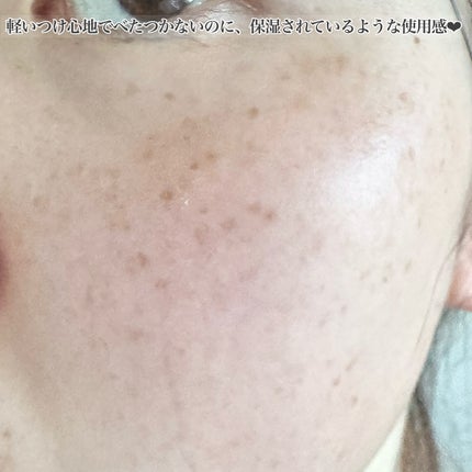 センテラ アンプル/SKIN1004/美容液を使ったクチコミ(5枚目)