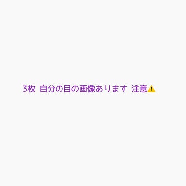 やっと奥二重？になれました…！
バンザイ！！！
ルド⚫ーブルとか二重のりを使っても手術失敗した人みたいになってがっくりしてたのですが、この度アイテープくんが頑張ってくれました…
1パック全て失敗しました