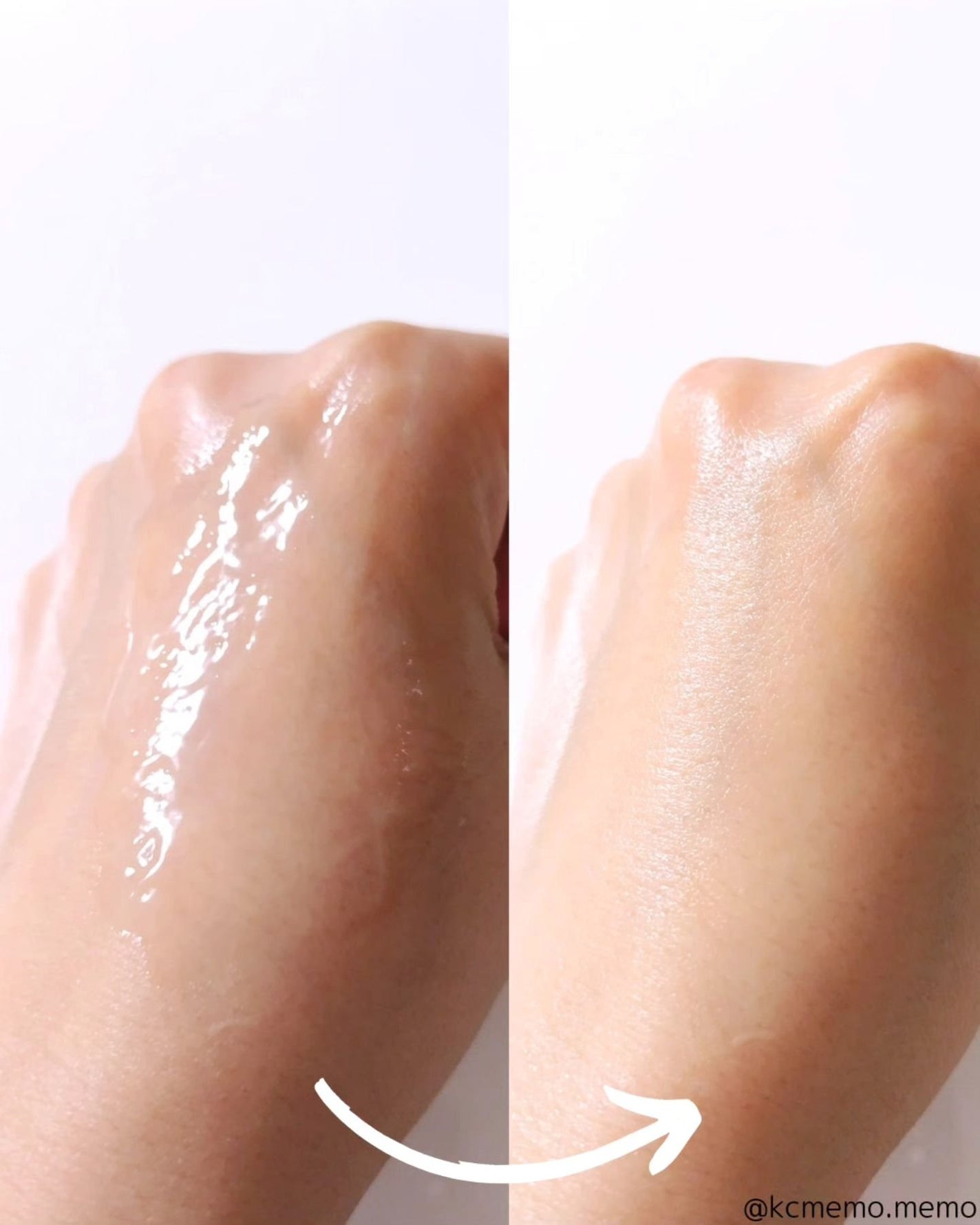 ダーマアンサー PDRN アクティブブースト1:1アンプル/CNP Laboratory/美容液を使ったクチコミ(5枚目)