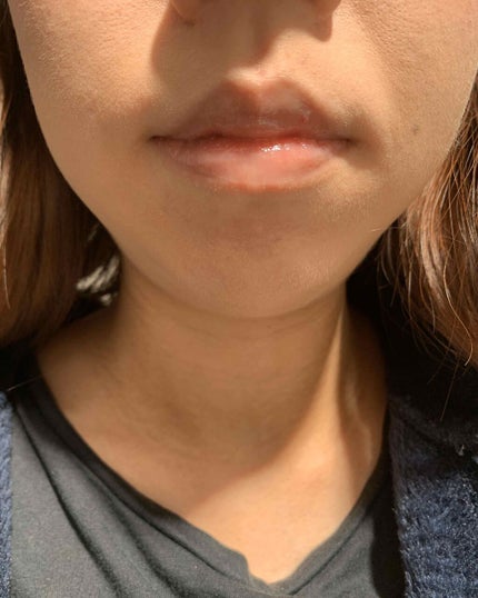 38°C / 99°F リップトリートメント (リップ美容液)/UZU BY FLOWFUSHI/リップケアを使ったクチコミ(3枚目)