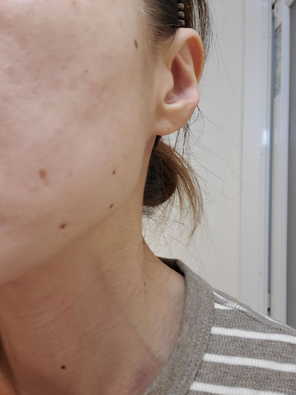 DETクリア ブライト&ピール ピーリングジェリー<ミックスフルーツの香り>/Detclear/ピーリングを使ったクチコミ(2枚目)