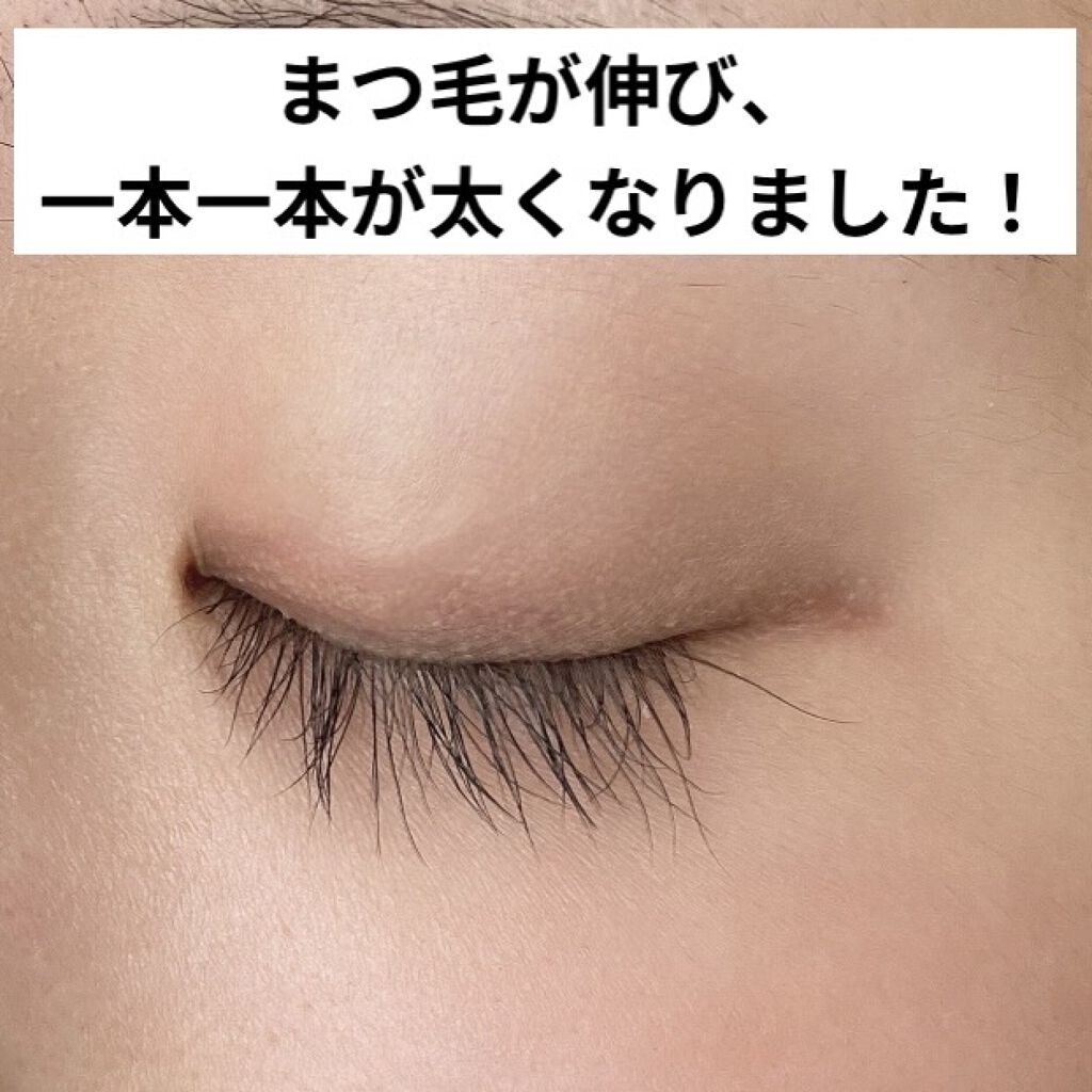 FEG  Eyelash  Enhancer/FEG/まつげ美容液を使ったクチコミ（2枚目）