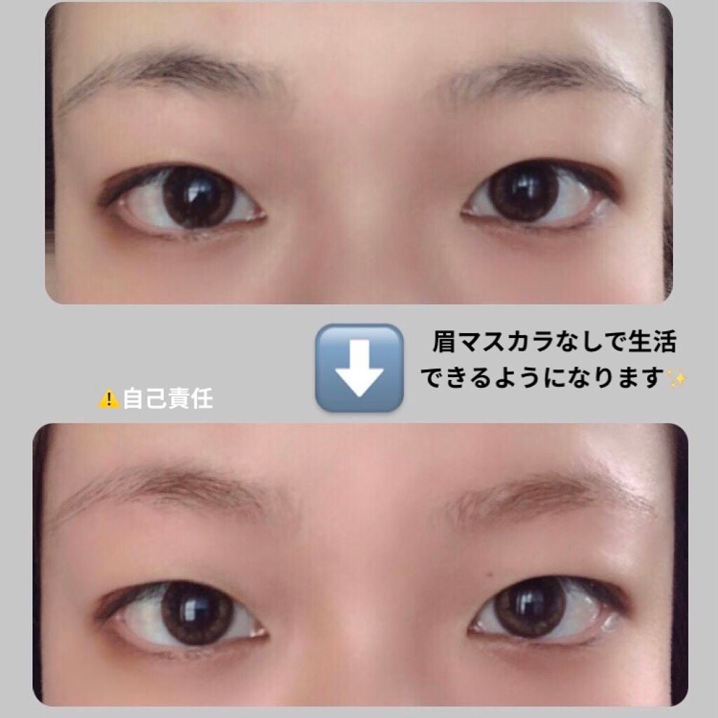 脱色クリーム 敏感肌用/エピラット/ムダ毛ケアを使ったクチコミ(1枚目)