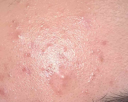 ミノン アミノモイスト 敏感肌・混合肌ライン トライアルセット/ミノン/トライアルキットを使ったクチコミ(3枚目)