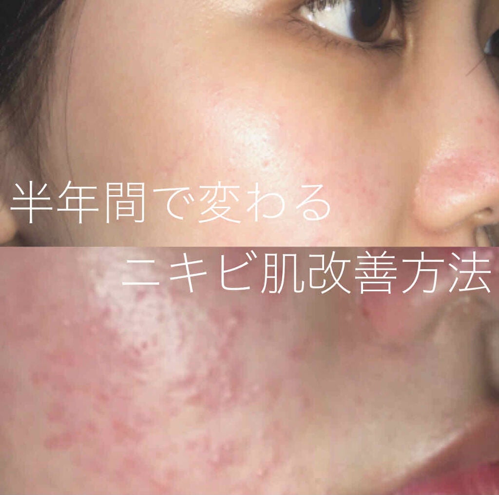 スキンコンディショナー高保湿/CEZANNE/化粧水を使ったクチコミ(1枚目)