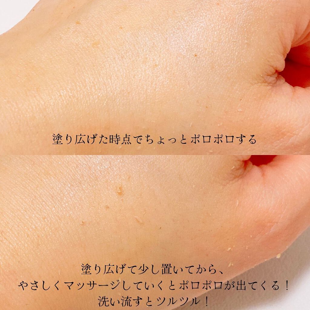 えび松(春br) on LIPS 「株式会社シーヴァ様より薬用ピーリングスムーサーEXWをお試..」(5枚目)