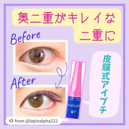 ルドゥーブル/ルドゥーブル/二重まぶた用アイテムを使ったクチコミ(1枚目)