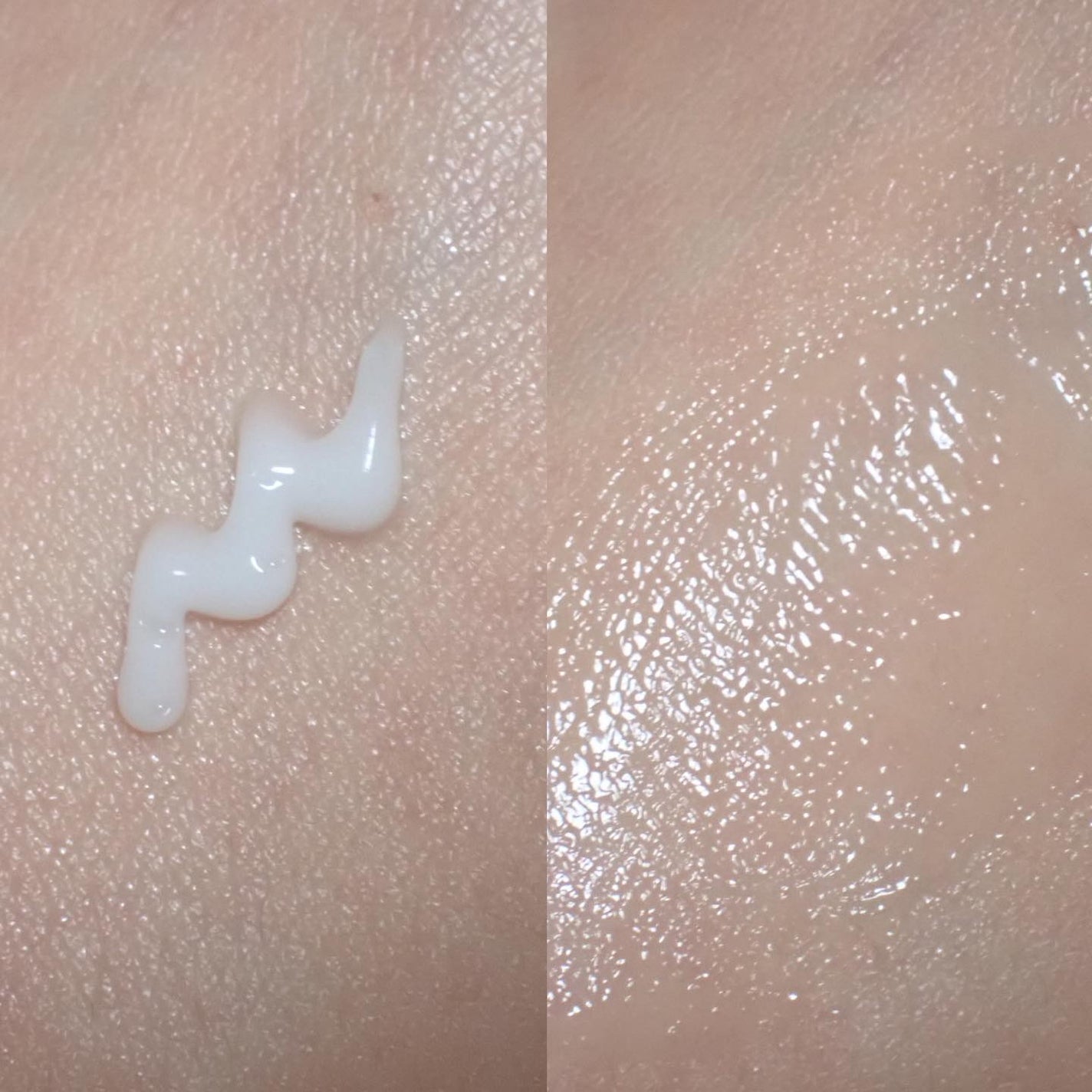 BP-PORE AMPOULE /Dr.Melaxin/美容液を使ったクチコミ(8枚目)