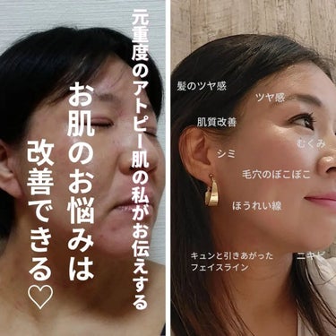 美肌カウンセラー💆綺麗のお助け相談所 on LIPS 「スノウライクの白雪姫パックナヨンちゃんが自身のInstagra..」（2枚目）