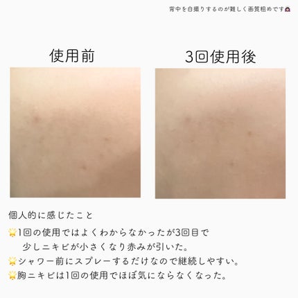 レッドアクネ ボディピーリングショット/MEDICUBE/ピーリングを使ったクチコミ(3枚目)