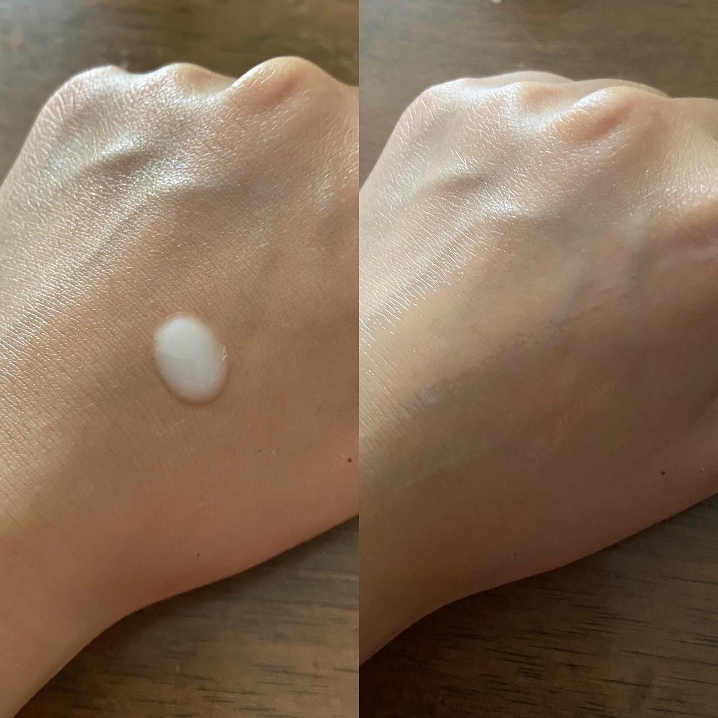 スキンピールバー ティートゥリー/サンソリット/洗顔石鹸を使ったクチコミ(5枚目)