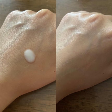 スキンピールバー ティートゥリー/サンソリット/洗顔石鹸を使ったクチコミ(5枚目)