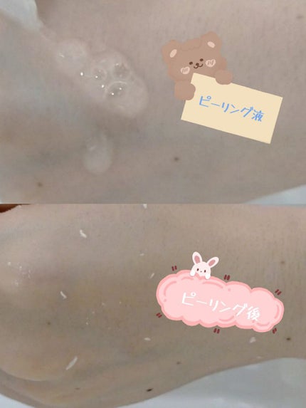 そのまま! ハトムギエキス配合ピーリングジェルのクチコミ「首イボやザラザラ対策に評価が高かった、
ハトムギエキスが入ったプチプラピーリング。
※他投.....」(3枚目)