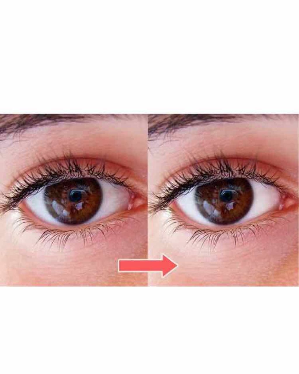 ロートリセ 医薬品 ロート製薬の口コミ これ 1本でうるうるでクリアな目に By ﾋﾟﾛﾋﾟ 混合肌 10代後半 Lips