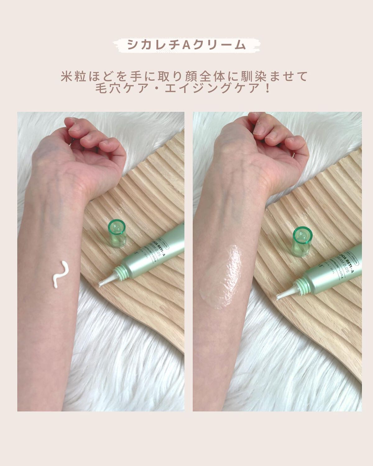 シカレチA エッセンス0.1/VT/美容液を使ったクチコミ（3枚目）