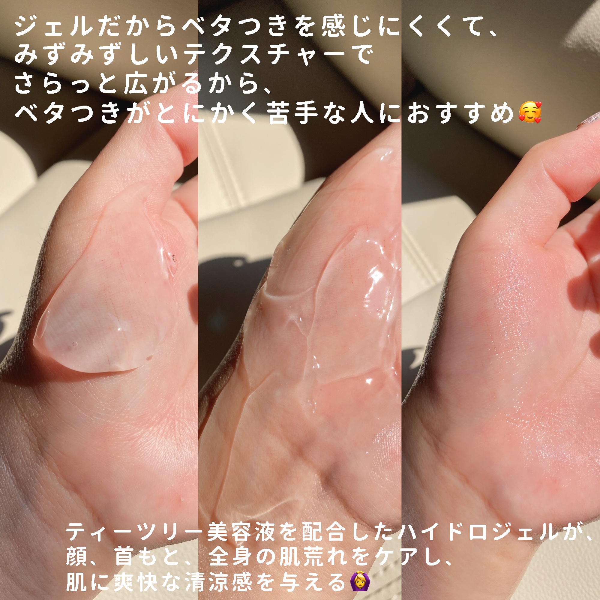 ティーツリーカーミングハイドロジェル/MEDIHEAL/ボディローションを使ったクチコミ（2枚目）