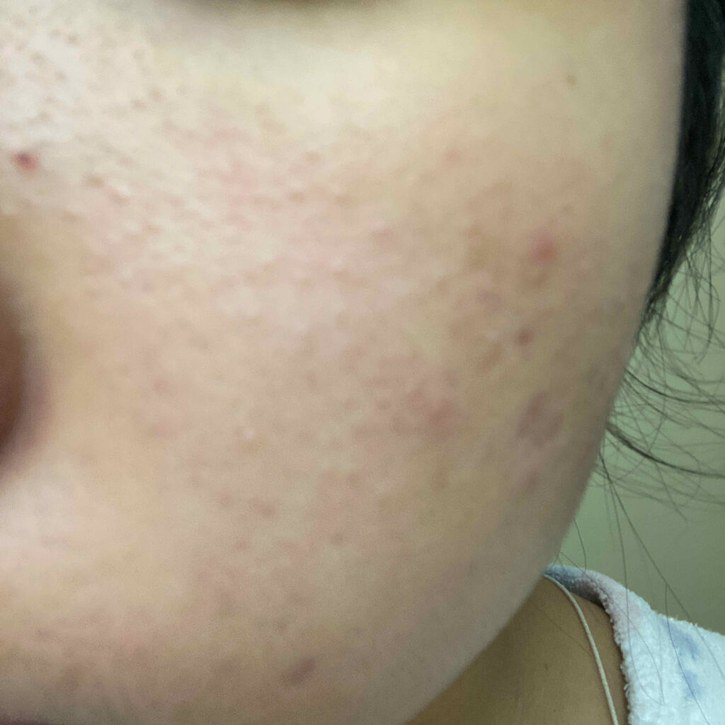 を使ったクチコミ（1枚目）