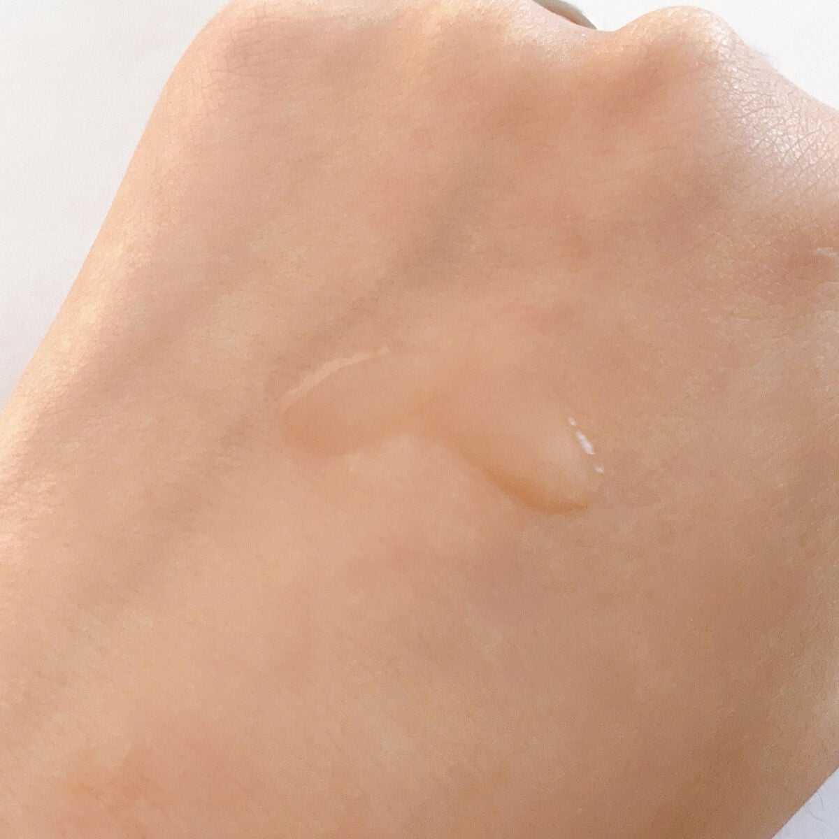 AD コントロール ローション/ACSEINE/化粧水を使ったクチコミ(4枚目)