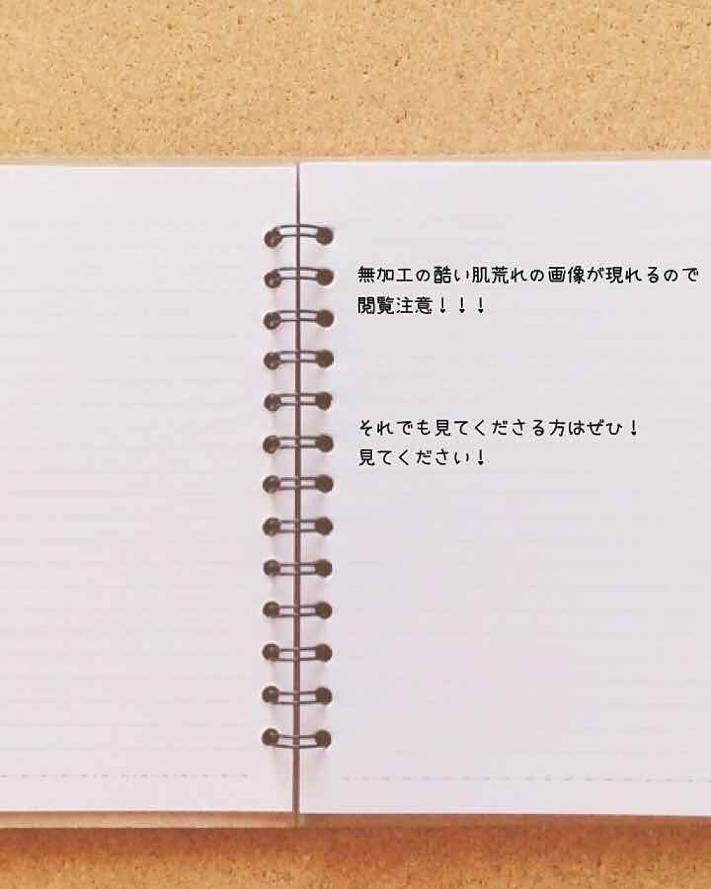 薬用 しみ 集中対策 美容液/メラノCC/美容液を使ったクチコミ(1枚目)