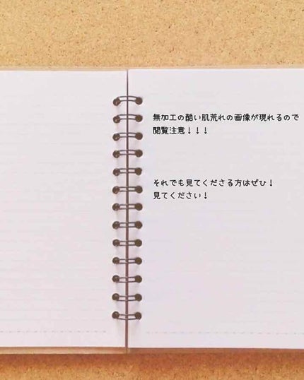 薬用 しみ 集中対策 美容液/メラノCC/美容液を使ったクチコミ(1枚目)