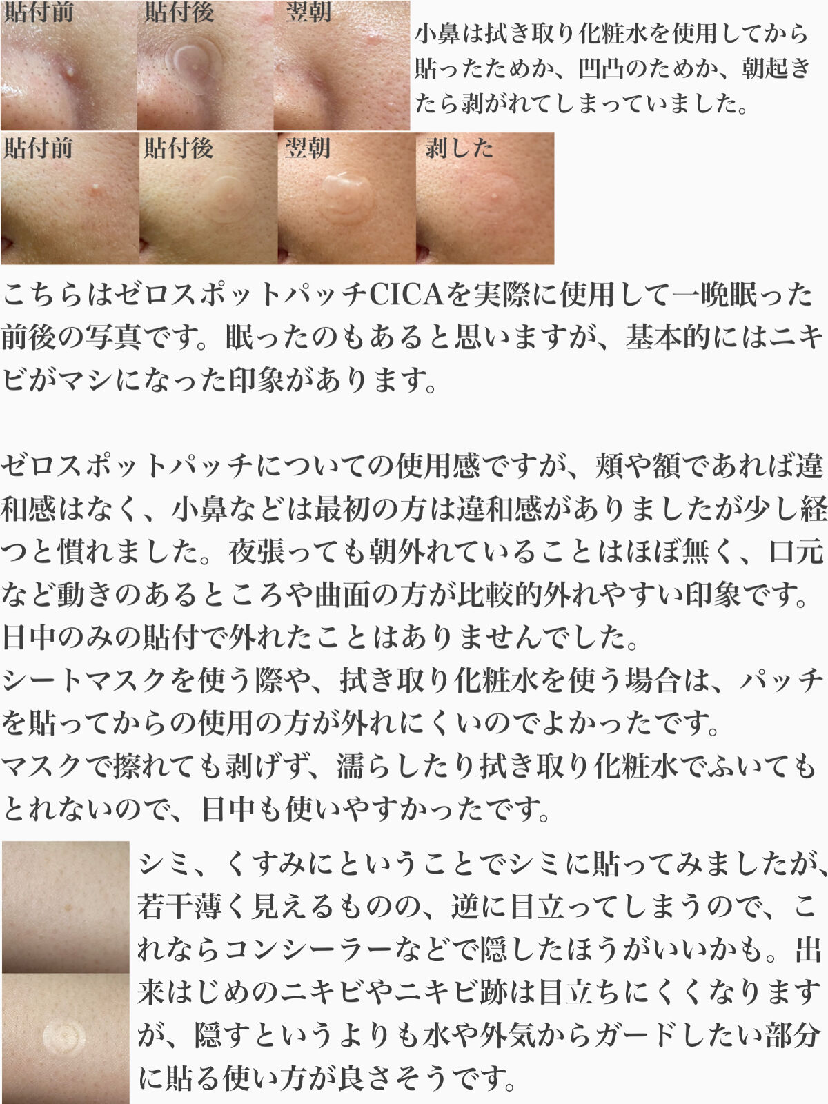 ゼロスポットパッチ｜Today's Cosmeの使い方を徹底解説 - ※Twitterに