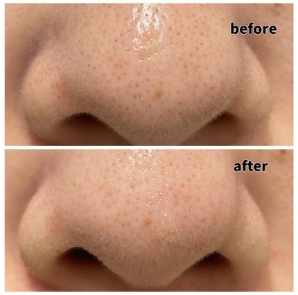 PROBIODERM™︎ Collagen Remodeling Deep Cleansing Balm/BIOHEAL BOH/クレンジングバームを使ったクチコミ(3枚目)