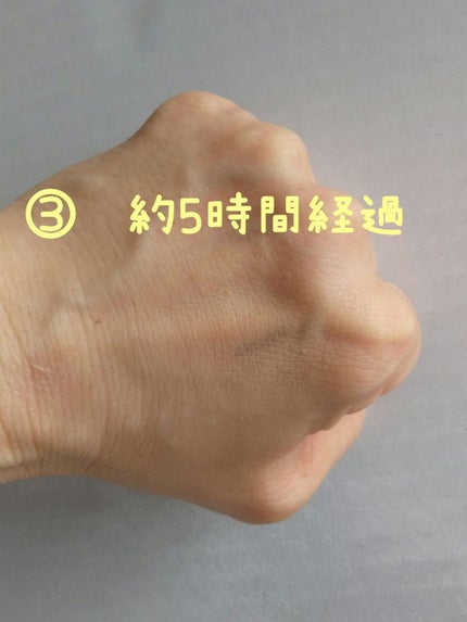 スポッツカバー ファウンデイション/SHISEIDO/クリームコンシーラーを使ったクチコミ(7枚目)