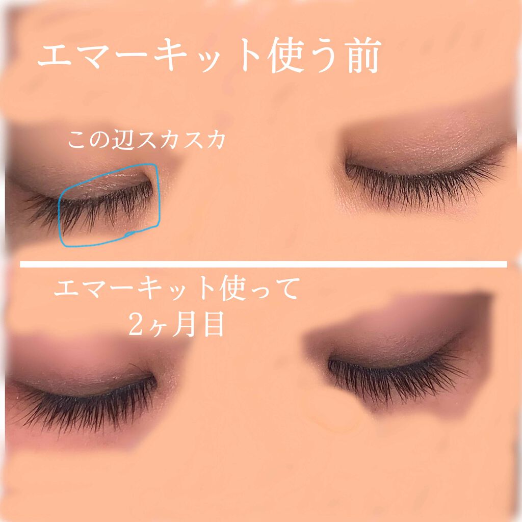 スカルプD ボーテ ピュアフリーアイラッシュセラム/アンファー(スカルプD)/まつげ美容液を使ったクチコミ（1枚目）