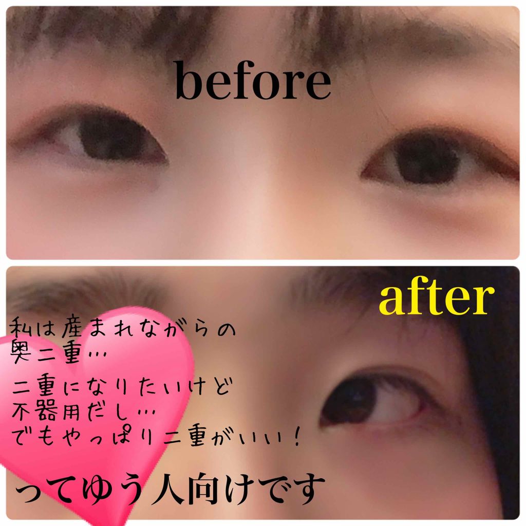 しなやかフィット/DAISO/二重まぶた用アイテムを使ったクチコミ（1枚目）
