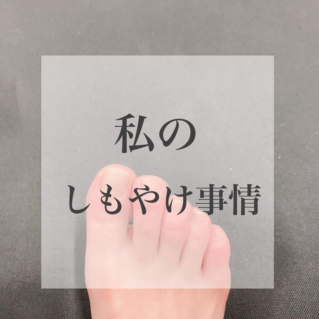 オロナインH軟膏 (医薬品)/オロナイン/その他を使ったクチコミ(1枚目)