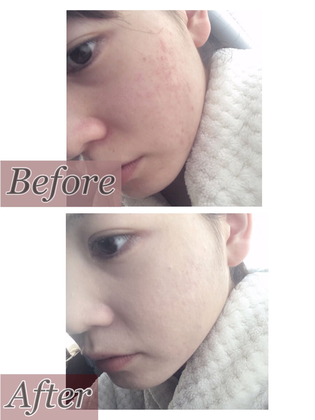 【旧】ディオールスキン フォーエヴァー スキン コレクト コンシーラー/Dior/リキッドコンシーラーを使ったクチコミ(3枚目)