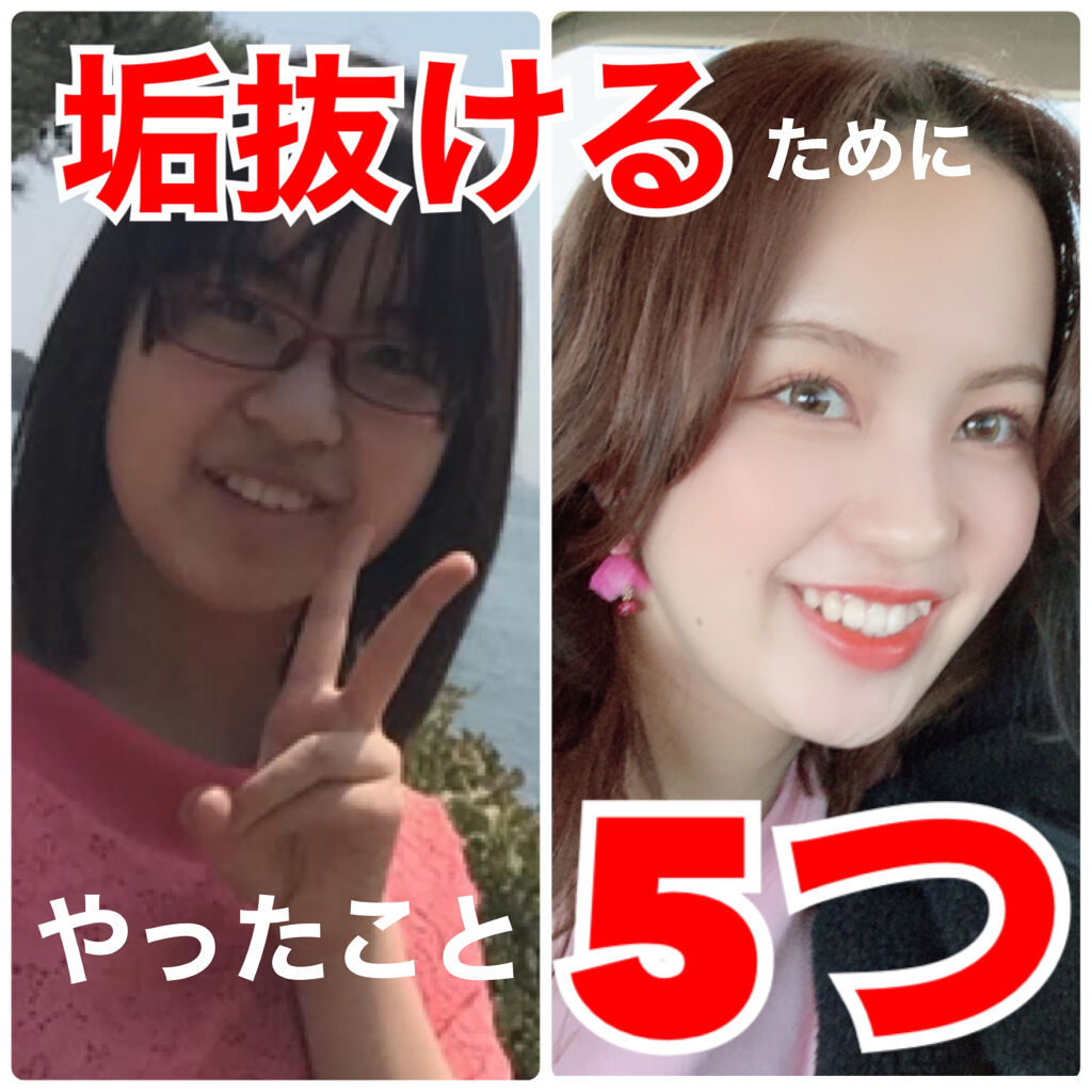 アンリミテッド グロー フルイド 474/shu uemura/リキッドファンデーションを使ったクチコミ（1枚目）