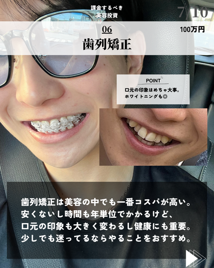 ほづ|メンズ美容で清潔感を上げる on LIPS 「「絶対にやるべき美容投資7選」僕が普段使ってるその他のおすす..」(7枚目)