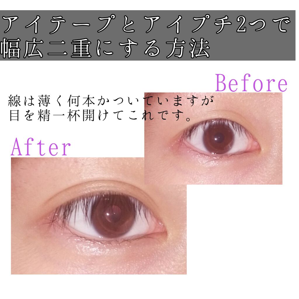 アイトーク/アイトーク/二重まぶた用アイテムを使ったクチコミ（1枚目）
