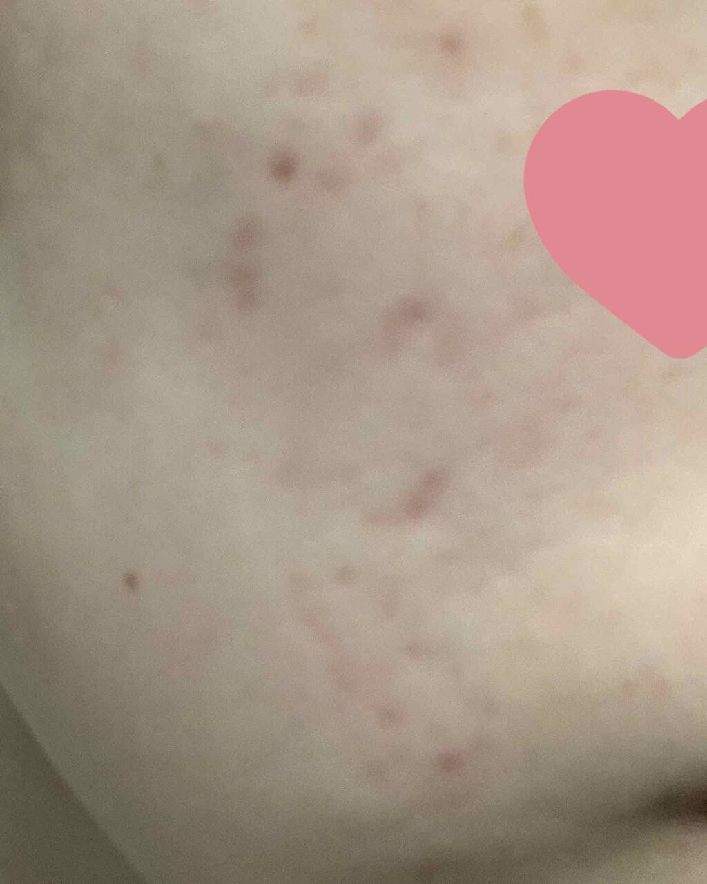 AHA·BHA·PHA 30デイズミラクルトナー/SOME BY MI/化粧水を使ったクチコミ(2枚目)