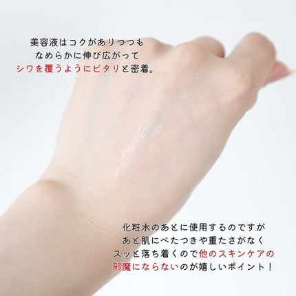 リンクルショット メディカル セラム N/リンクルショット/アイケア・アイクリームを使ったクチコミ(4枚目)