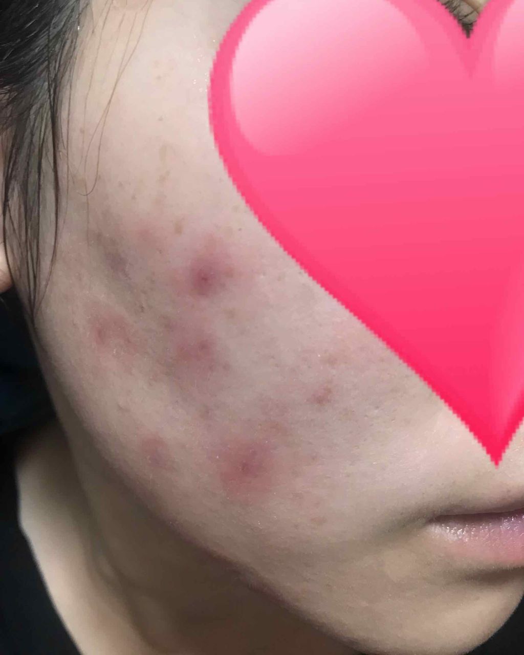 ハンガー on LIPS 「芯みたいなのは無くなったけど塗った瞬間からかゆみ!!2週間使っ..」(3枚目)