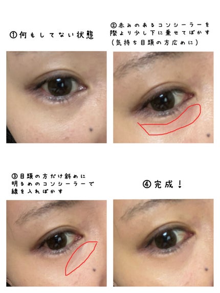 ラディアント タッチ/YVES SAINT LAURENT BEAUTE/リキッドコンシーラーを使ったクチコミ(2枚目)