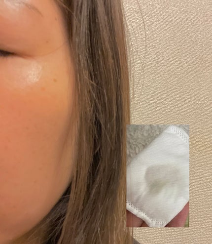 リアルコラーゲン テンションアップ濃縮トナー/ダーマフィックス/化粧水を使ったクチコミ(4枚目)