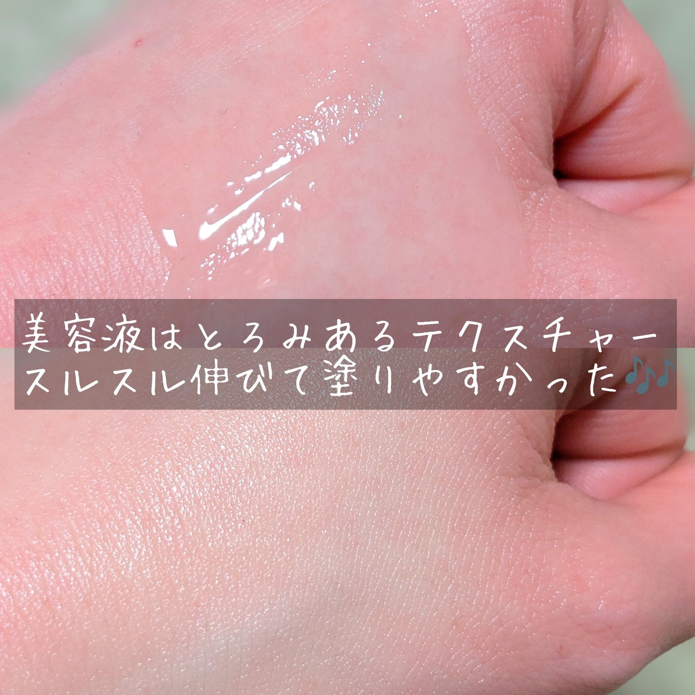 TX-Cream/Dr.Melaxin/フェイスクリームを使ったクチコミ(4枚目)