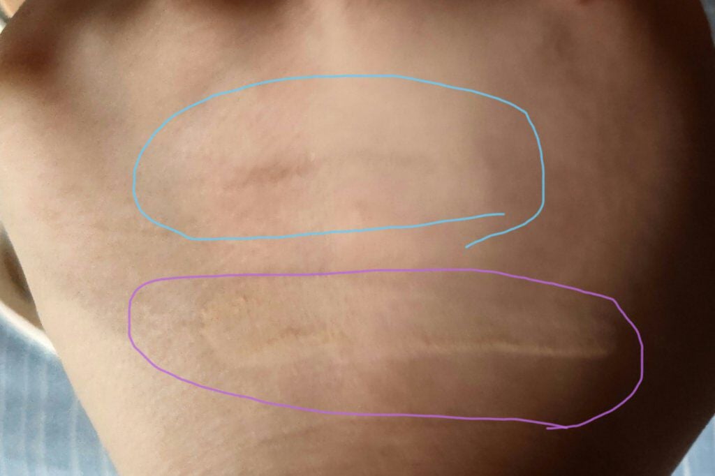 ホワイト パウダレスト/ALBION/パウダーファンデーションを使ったクチコミ(3枚目)