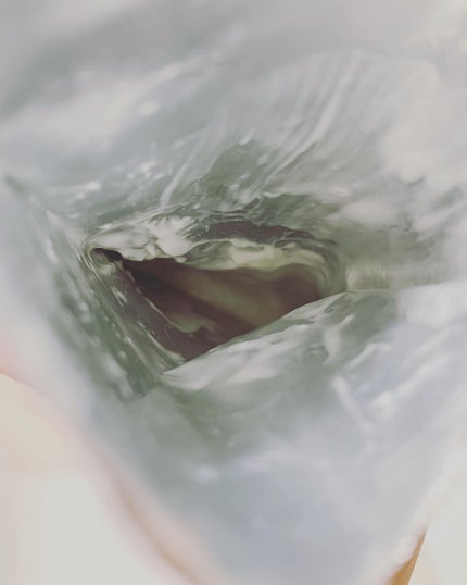 D:NA プロアチンマスク/MEDIHEAL/シートマスク・パックを使ったクチコミ(5枚目)