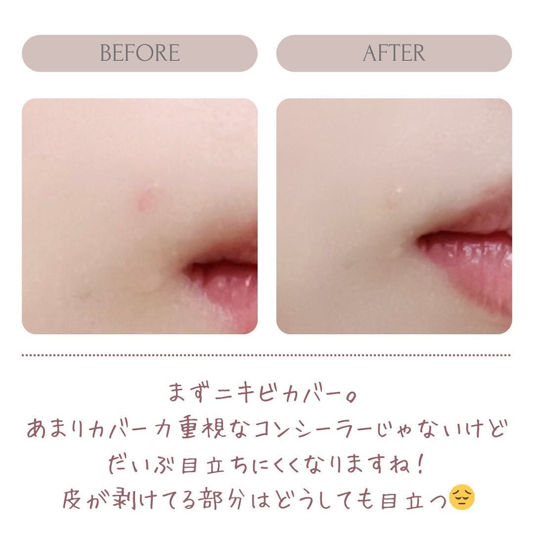 ミックスマッチコンシーラー/BLING GLOW/パレットコンシーラーを使ったクチコミ(4枚目)