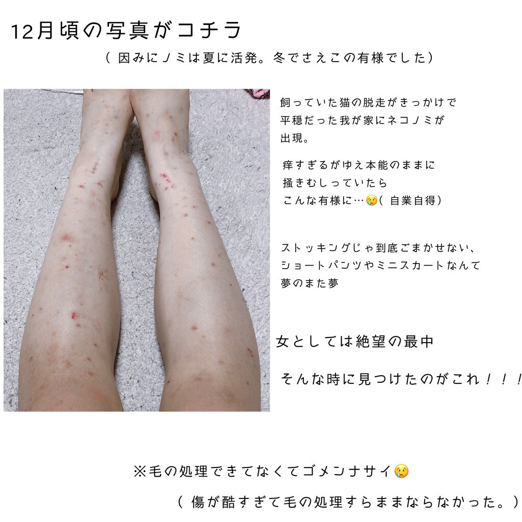 を使ったクチコミ（2枚目）